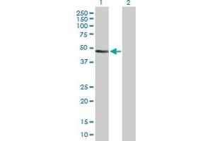 Western Blot analysis of ANLN expression in transfected 293T cell line by ANLN MaxPab polyclonal antibody. (Anillin antibody  (AA 1-405))