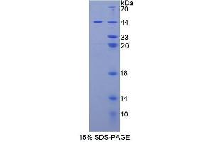 SDS-PAGE (SDS) image for Prolactin-Induced Protein (PIP) (AA 1-146) protein (His tag,GST tag) (ABIN2123514) (PIP Protein (AA 1-146) (His tag,GST tag))