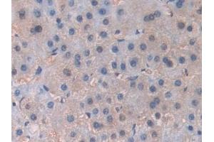 Immunohistochemistry (IHC) image for anti-Phosphoinositide-3-Kinase, Catalytic, beta Polypeptide (PIK3CB) (AA 807-1070) antibody (ABIN7437749)