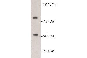 Western Blotting (WB) image for anti-Vitamin K-dependent protein C (PROC) antibody (ABIN1855001) (PROC antibody)