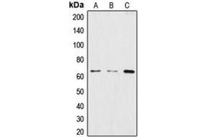 Western blot analysis of CstF-64 expression in HeLa (A), BJAB (B), THP1 (C) whole cell lysates. (CSTF2 antibody  (N-Term))