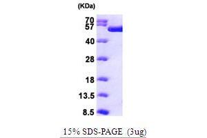 RuvB-Like 1 (E. Coli) (RUVBL1) (AA 1-456) protein (His tag)