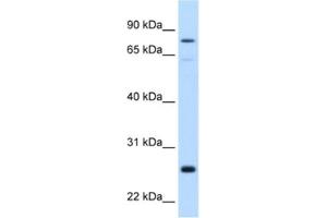 Western Blotting (WB) image for anti-Glutathione S-Transferase mu 2 (Muscle) (GSTM2) antibody (ABIN2462480) (GSTM2 antibody)