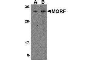 Western blot analysis of MORF4 in K562 cell lysate with MORF4 antibody at (A) 1 and (B) 2 μg/ml. (MORF4 antibody  (N-Term))