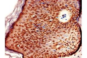 Immunohistochemistry of paraffin-embedded human skin tissue using ABIN7151618 at dilution of 1:100 (ERVK-6 antibody  (AA 90-632))