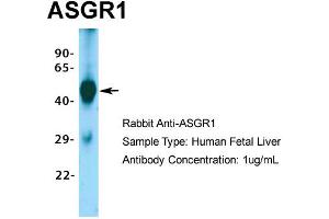 Host: Rabbit Target Name: ASGR1 Sample Type: Human Fetal Liver Antibody Dilution: 1. (Asialoglycoprotein Receptor 1 antibody  (Middle Region))