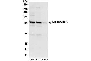 anti-Huntingtin Interacting Protein 1 Related (HIP1R) (AA 1018-1068) antibody