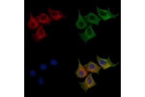 ABIN7094235 and ABIN7098282 staining HepG2 cells by IF/ICC.