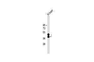 Anti-HP Antibody (Center) at 1:8000 dilution + Human liver lysate Lysates/proteins at 20 μg per lane. (Haptoglobin antibody  (Center))