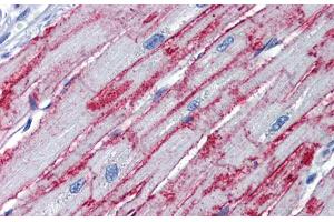 Immunohistochemistry with Human Heart lysate tissue at an antibody concentration of 5. (PNPT1 antibody  (Middle Region))
