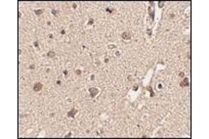 Immunohistochemistry (Paraffin-embedded Sections) (IHC (p)) image for anti-Autophagy Related 12 (ATG12) (N-Term) antibody (ABIN497963)