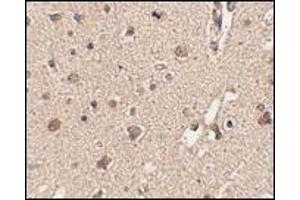 Immunohistochemistry: ATG12 antibody staining of Human brain tissue at 2.