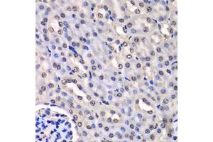 Immunohistochemistry of paraffin-embedded mouse kidney using HNRNPM antibody (ABIN5975447) at dilution of 1/100 (40x lens). (HNRNPM antibody)