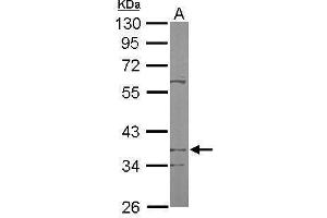 WB Image Sample (50 ug of whole cell lysate) A: Mouse brain 10% SDS PAGE antibody diluted at 1:1000 (PDSS2 antibody)