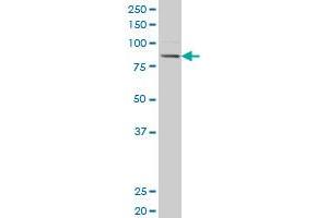 ACSL3 polyclonal antibody (A01), Lot # 051220JC01 Western Blot analysis of ACSL3 expression in 293 . (Acsl3 antibody  (AA 203-288))