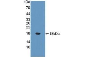 Detection of Recombinant vWF, Human using Polyclonal Antibody to Von Willebrand Factor (vWF) (VWF antibody  (AA 1498-1665))