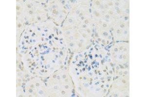 Immunohistochemistry of paraffin-embedded Rat kidney using KAT2A Polyclonal Antibody at dilution of 1:100 (40x lens). (KAT2A antibody)