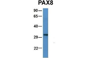 Host:  Rabbit  Target Name:  PAX8  Sample Type:  Human 721_B  Antibody Dilution:  1. (PAX5 antibody  (N-Term))