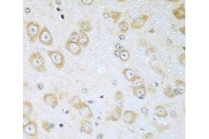 Immunohistochemistry of paraffin-embedded Mouse brain using ACOX1 Polyclonal Antibody at dilution of 1:100 (40x lens). (ACOX1 antibody)