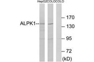 Western blot analysis of extracts from COLO/HepG2 cells, using ALPK1 Antibody. (ALPK1 antibody  (AA 11-60))