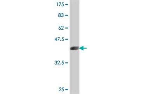 QPRT antibody  (AA 198-297)