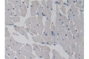 TRPM7 antibody  (AA 19-179)