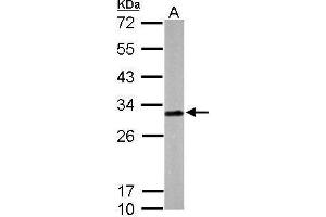 Western Blotting (WB) image for anti-Latexin (LXN) antibody (ABIN2856486)