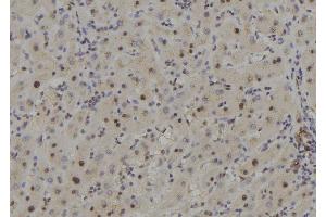 ABIN6278350 at 1/100 staining Human liver tissue by IHC-P.