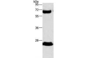 Western Blot analysis of Human fetal liver tissue using GGT1 Polyclonal Antibody at dilution of 1:300
