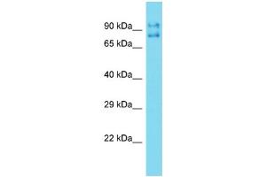 Western Blotting (WB) image for anti-Tigger Transposable Element Derived 5 (TIGD5) (N-Term) antibody (ABIN2500287) (TIGD5 antibody  (N-Term))