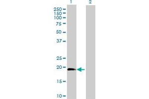 Western Blot analysis of IL1RN expression in transfected 293T cell line by IL1RN MaxPab polyclonal antibody. (IL1RN antibody  (AA 1-177))
