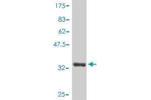 Western Blot detection against Immunogen (34. (LSM6 antibody  (AA 1-80))