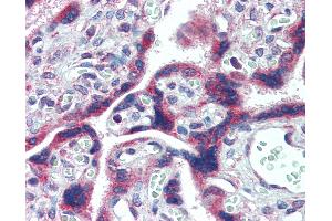 Anti-FMR1 antibody IHC of human placenta. (FMR1 antibody  (AA 594-607))