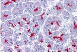 Pancreas, Human: Formalin-Fixed, Paraffin-Embedded (FFPE) (MUC1 antibody)