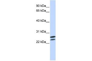 WB Suggested Anti-HOXB4 Antibody   Titration: 1 ug/ml   Positive Control: Jurkat Whole Cell (HOXB4 antibody  (N-Term))