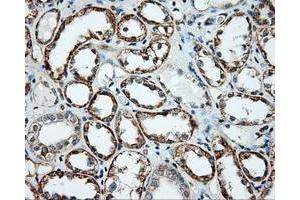 Immunohistochemical staining of paraffin-embedded liver tissue using anti-NME4 mouse monoclonal antibody. (NME4 antibody)