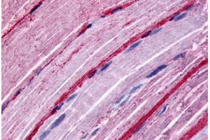Myocytes, Human: Formalin-Fixed Paraffin-Embedded (FFPE) (GRK5 antibody  (Internal Region))