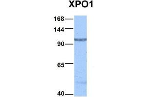 Host:  Rabbit  Target Name:  XPO1  Sample Type:  Hela  Antibody Dilution:  1. (XPO1 antibody  (C-Term))