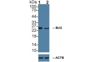 Western blot analysis of (1) Wild-type HL-60 cell lysate, and (2) Bcl2 knockout HL-60 cell lysate, using Rabbit Anti-Mouse BCL2 Antibody (5 µg/ml) and HRP-conjugated Goat Anti-Mouse antibody (abx400001, 0.