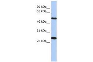 Image no. 1 for anti-Transmembrane Protein 161B (TMEM161B) (AA 71-120) antibody (ABIN6741235) (TMEM161B antibody  (AA 71-120))