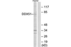 Western blot analysis of extracts from HepG2 cells, using DDX51 Antibody. (DDX51 antibody  (AA 617-666))