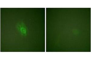 Immunofluorescence analysis of HeLa cells treated with TNF-a 20nM 15', using IkappaB-beta (Phospho-Ser23) Antibody. (NFKBIB antibody  (pSer23))