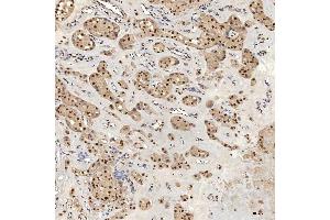 IHC analysis of U1A/SNRPA using anti-U1A/SNRPA antibody (ABIN7600891). (SNRPA1 antibody  (AA 25-218))