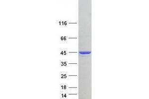 Validation with Western Blot (Cardiac Troponin T2 Protein (Transcript Variant 2) (Myc-DYKDDDDK Tag))