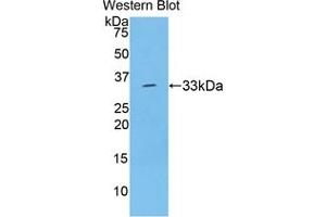 Western blot analysis of recombinant Rat TBG. (SERPINA7 antibody  (AA 114-391))