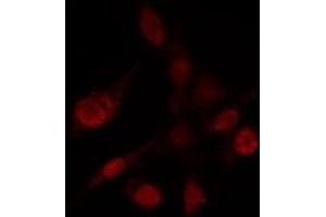 ABIN6272432 staining Hela by IF/ICC. (Sp3/4 antibody)