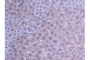 DAB staining on IHC-P; Samples: Mouse Liver Tissue (ABAT antibody  (AA 236-500))