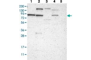 Western blot analysis of Lane 1: RT-4, Lane 2: U-251 MG, Lane 3: Human Plasma, Lane 4: Liver, Lane 5: Tonsil with C1orf71 polyclonal antibody .