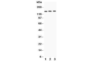 Western blot testing of Angiotensin Converting Enzyme antibody and Lane 1:  A549 (Angiotensin I Converting Enzyme 1 antibody  (N-Term))