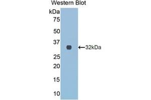 Detection of Recombinant COL3a1, Rat using Polyclonal Antibody to Collagen Type III Alpha 1 (COL3a1) (COL3A1 antibody  (AA 1171-1435))